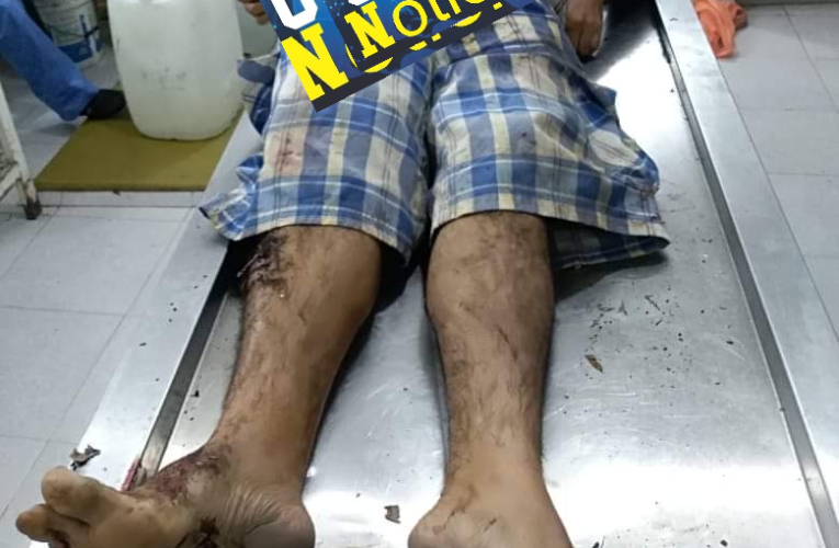 Matan a balazos a un hombre, en una huerta en la Costa Grande.