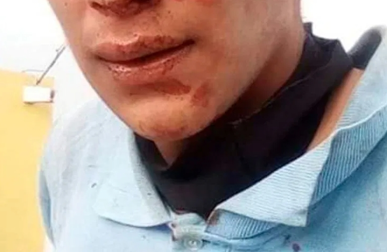Retienen y golpean a presunto delincuente en Haciendas de Tizayuca.
