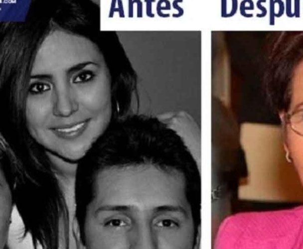 Segunda operación estética se realiza diputada de Atlixco Guadalupe muciño Muñoz.