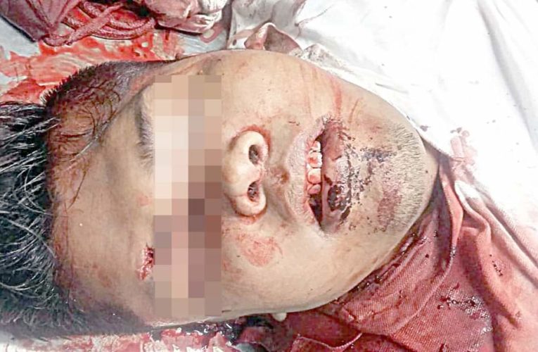Asesinan a taxista en Tepeacuilco.