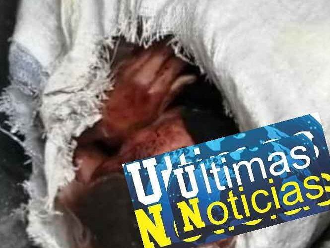 Localizan un hombre encostalado en una cueva en Taxco.