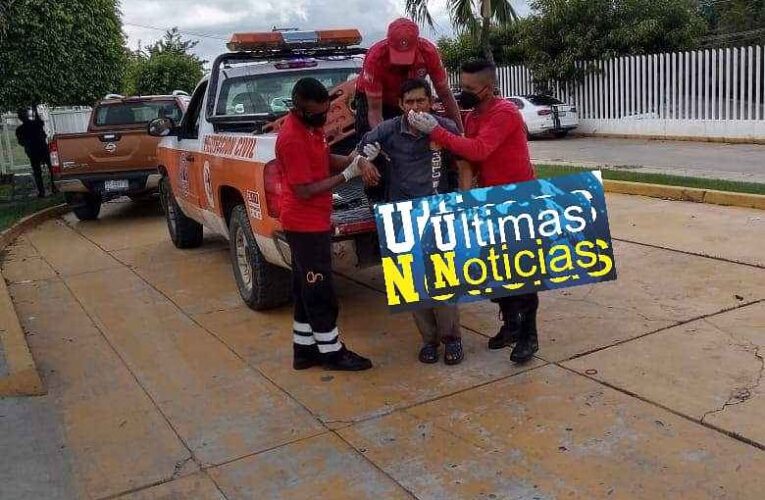 Balacean a un hombre en Ometepec