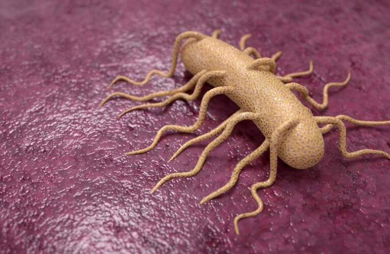 Alerta por bacteria mortal de embutidos en Nueva York; 1 persona fallecida.