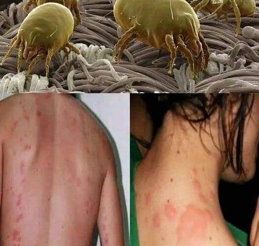 Limpia tu colchón de los terribles ácaros.!!